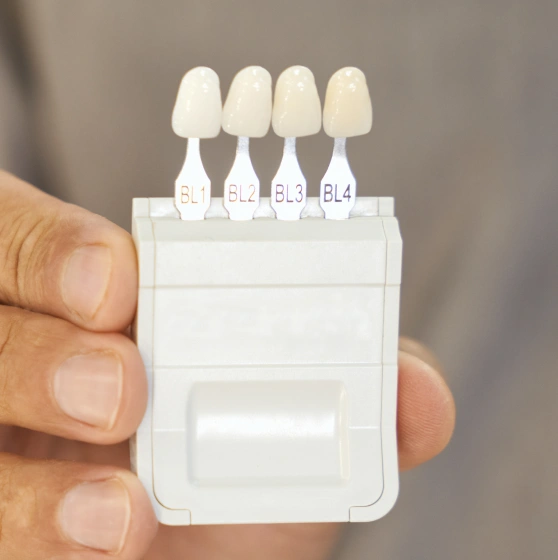 Hand holding a white dental veneer