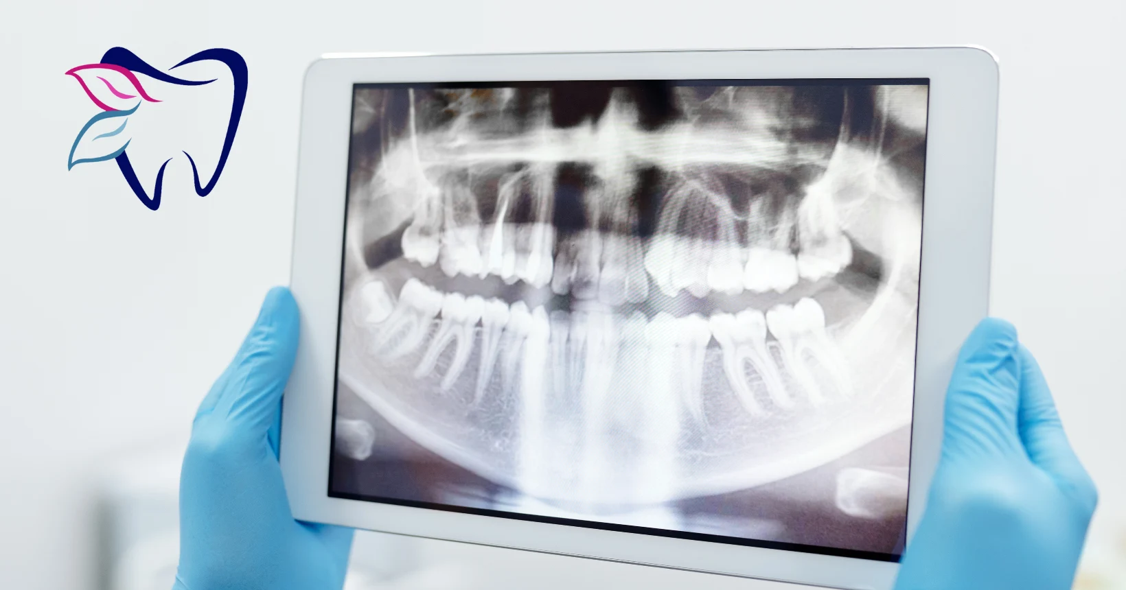Dental x ray showing a full set of teeth